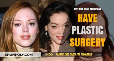Rose McGowan's Plastic Surgery: Unraveling the Reasons Behind Her Transformation