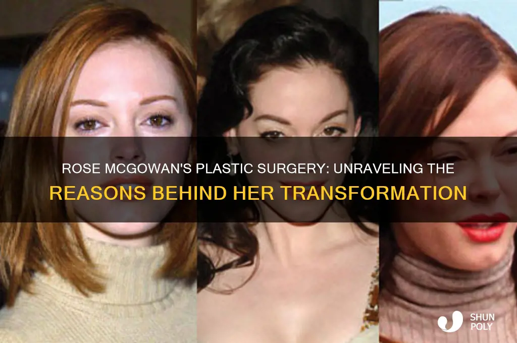 why did rose mcgowan have plastic surgery