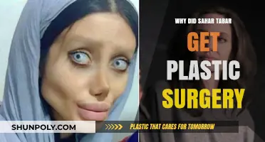 Sahar Tabar's Plastic Surgery: Unraveling the Reasons Behind Her Transformation