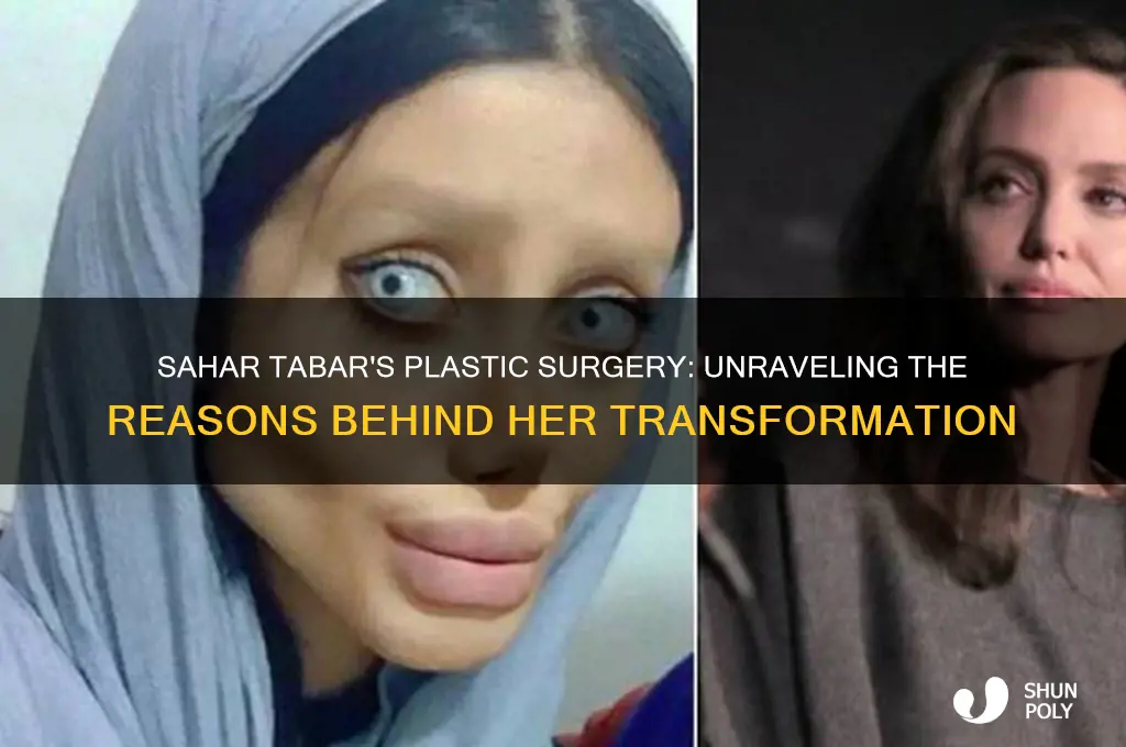 why did sahar tabar get plastic surgery