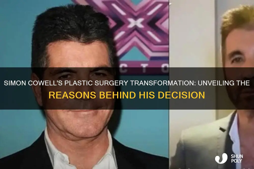 why did simon cowell get plastic surgery