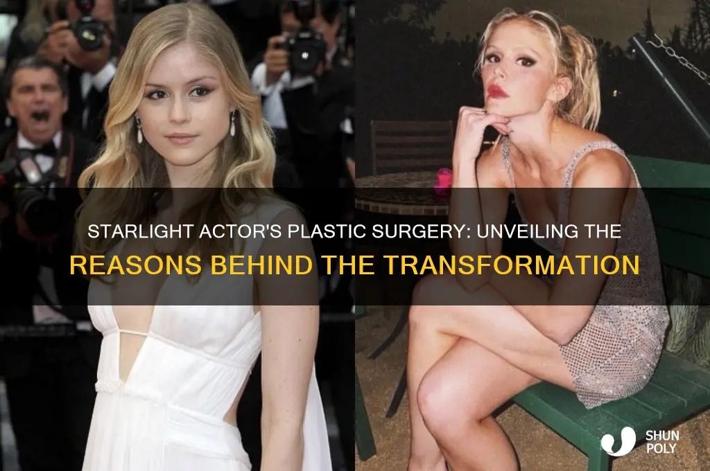 why did starlight actor get plastic surgery