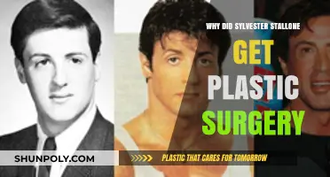 Sylvester Stallone's Plastic Surgery: Unveiling the Reasons Behind His Transformation