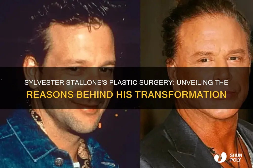 why did sylvester stallone get plastic surgery