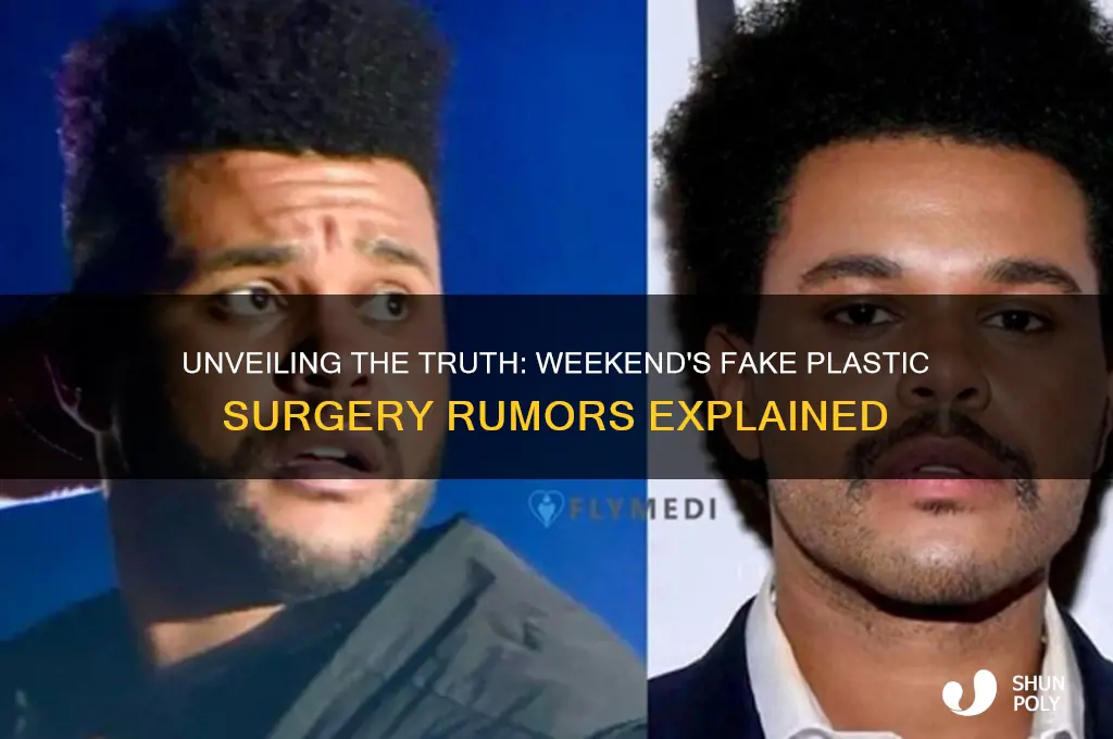 why did the weekend fake plastic surgery