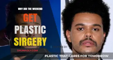 The Weeknd's Transformation: Unraveling the Reasons Behind His Plastic Surgery
