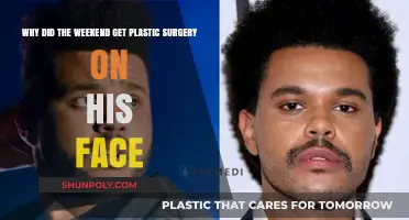 The Weeknd's Facial Transformation: Unraveling His Plastic Surgery Decision