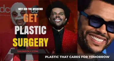 Why Did The Weeknd Undergo Plastic Surgery? Unveiling the Truth