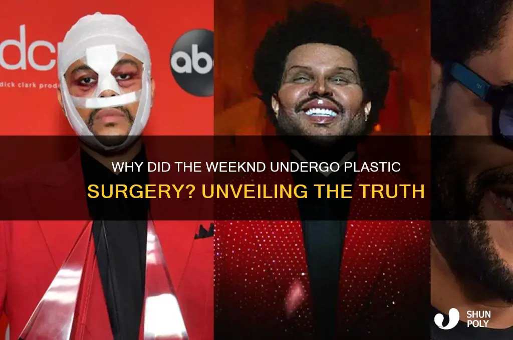 why did the weekend get plastic surgery