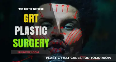 The Weeknd's Transformation: Uncovering the Reasons Behind His Plastic Surgery