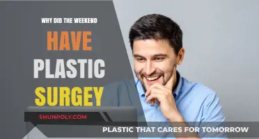 Weekend's Plastic Surgery: Why He Did It