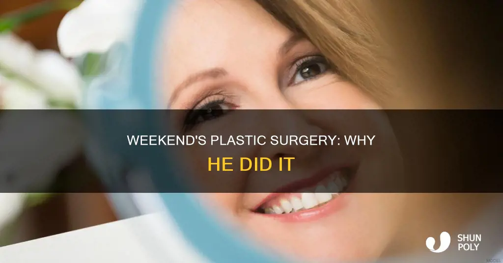 why did the weekend have plastic surgey