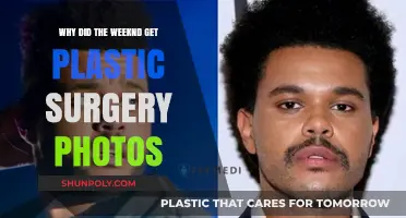The Weeknd's Plastic Surgery Photos: Unveiling the Transformation Truth