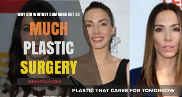Whitney Cummings' Plastic Surgery Transformation: Unraveling Her Beauty Evolution