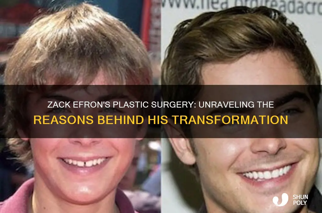 why did zack efron get plastic surgery