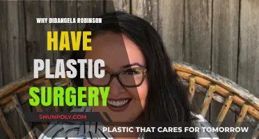 Angela Robinson's Plastic Surgery: Unveiling Her Transformation Journey