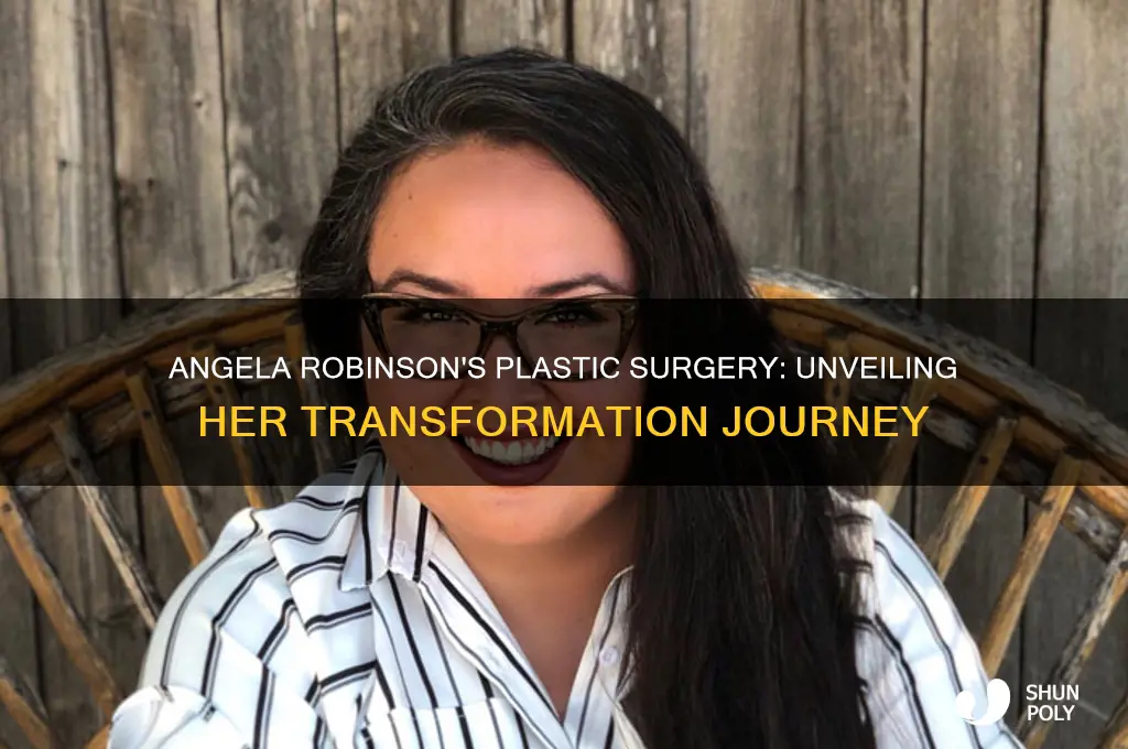 why didangela robinson have plastic surgery