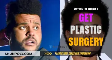 Why Did Weekend Undergo Plastic Surgery? Uncovering the Transformation