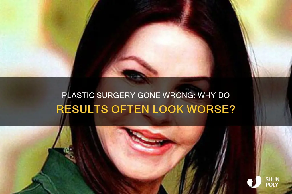 why do all plastic surgeons make people look worse