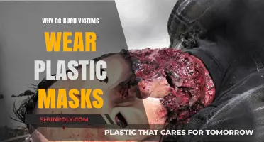 Plastic Masks: Burn Victims' Comfort and Healing