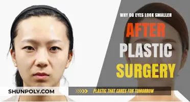 Why Plastic Surgery Can Make Eyes Appear Smaller: Explained