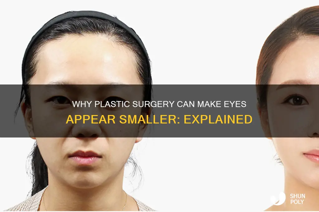 why do eyes look smaller after plastic surgery