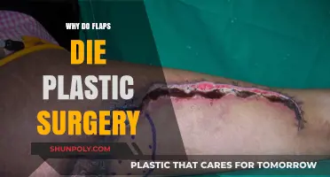 Why Flaps Fail in Plastic Surgery: Causes and Prevention Tips