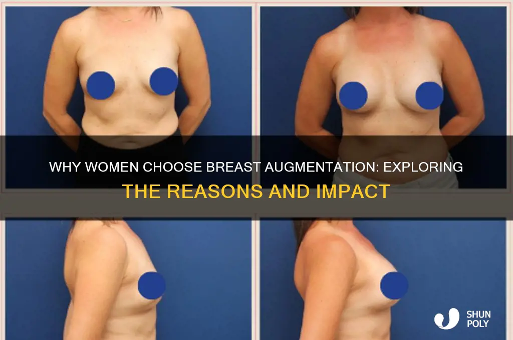 why do girls get plastic tits