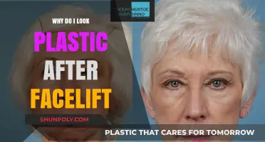Facelift Gone Wrong: Why Do I Look Plastic?