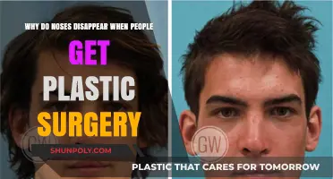 The Vanishing Nose: Uncovering Plastic Surgery's Most Puzzling Trend