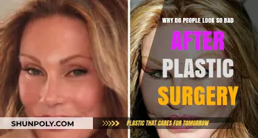 Plastic Surgery Gone Wrong: Unveiling the Reasons Behind Unnatural Looks