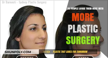 The Surprising Link Between Excessive Plastic Surgery and Nasal Changes