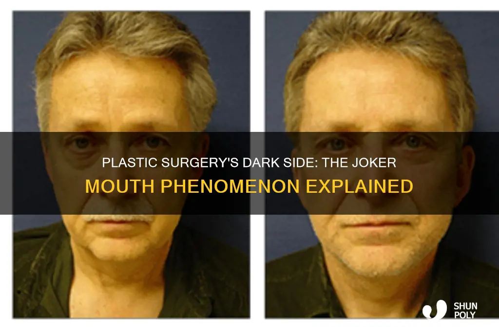 why do people with plastic surgery have jokers mouths