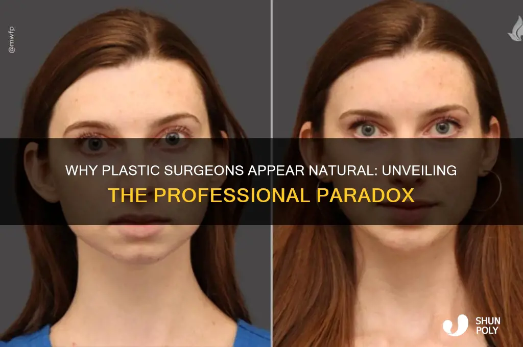why do plastic surgeons look normal