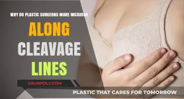 Why Plastic Surgeons Prefer Cleavage Line Incisions for Natural Results