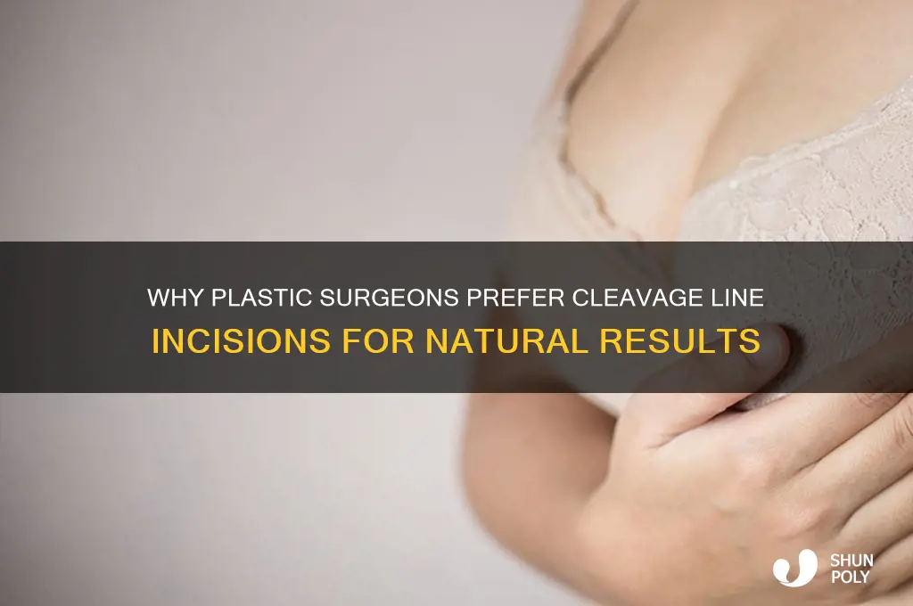 why do plastic surgeons make incisions along cleavage lines