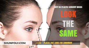 Why Plastic Surgery Noses Often Look Alike: Trends and Techniques