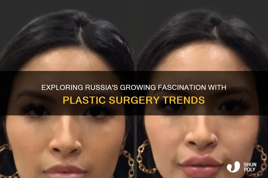 why do russians like plastic surgery