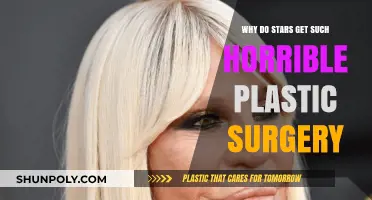 The Dark Side of Fame: Why Stars Opt for Disastrous Plastic Surgery
