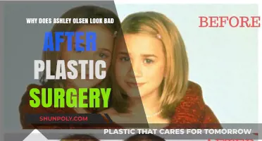Ashley Olsen's Plastic Surgery: Unraveling the Unfortunate Transformation