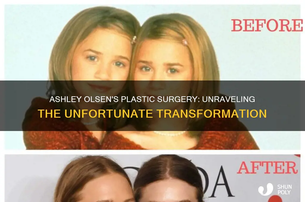 why does ashley olsen look bad after plastic surgery