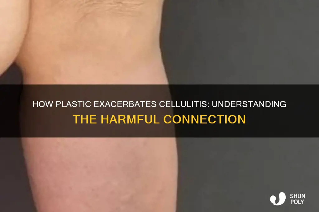 why does plastic make cellulitis worse