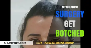 Unveiling the Risks: Why Plastic Surgery Sometimes Goes Terribly Wrong