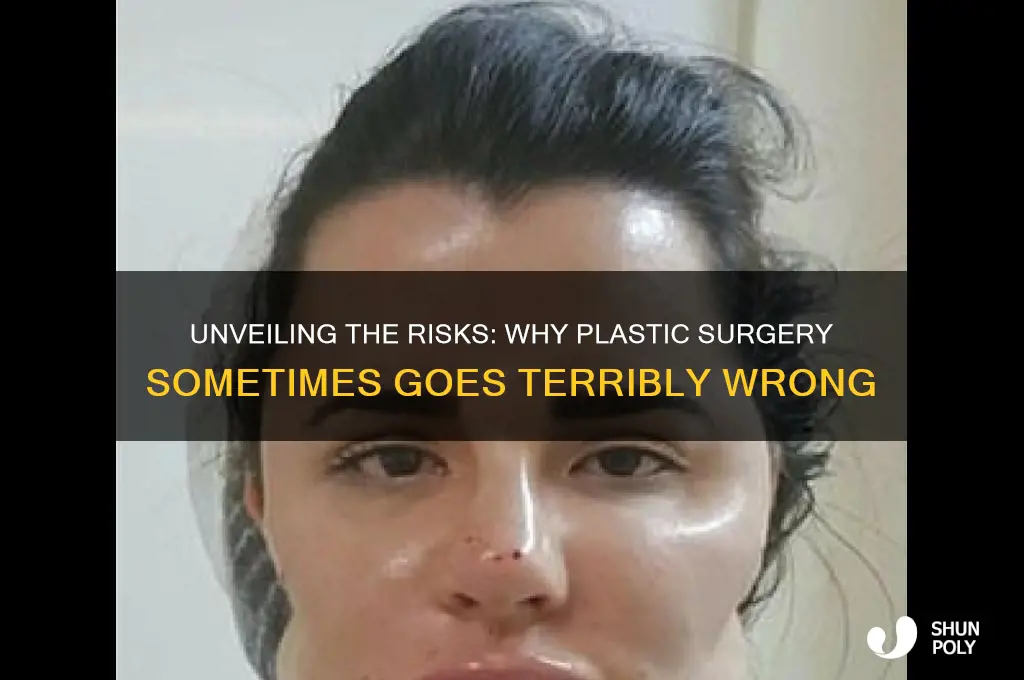 why does plastic surgery get botched