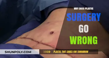 Unveiling the Risks: Why Plastic Surgery Sometimes Fails