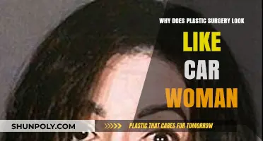 Plastic Surgery's Uncanny Valley: Why Some Results Resemble Car Women