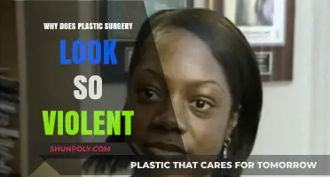 The Shocking Truth: Why Plastic Surgery Often Appears Brutal