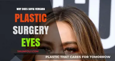 Sofia Vergara's Eye Transformation: Plastic Surgery Speculations Explored