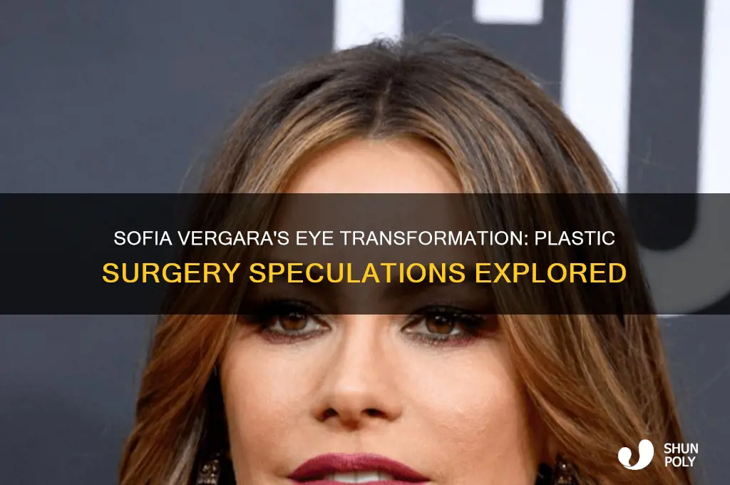 why does sofia vergara plastic surgery eyes