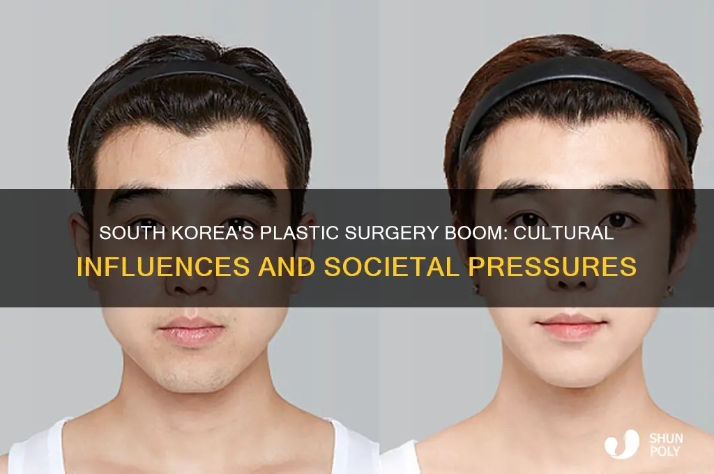why does south korea have so much plastic surgery